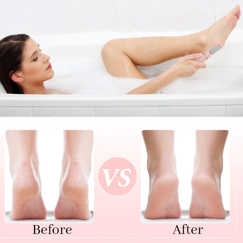 Electric Foot Grinder
